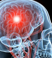 Patologia cerebrala