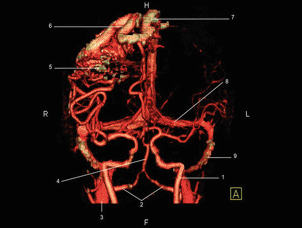 Atlas of CT Angyography